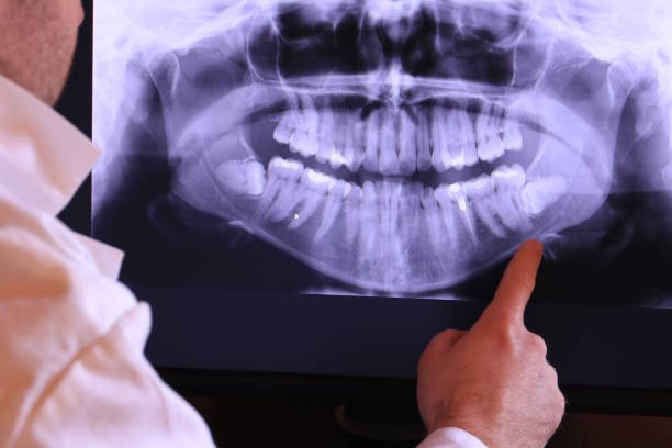 Best Emergency Dental Care for Abscessed Tooth in Gibson, AR