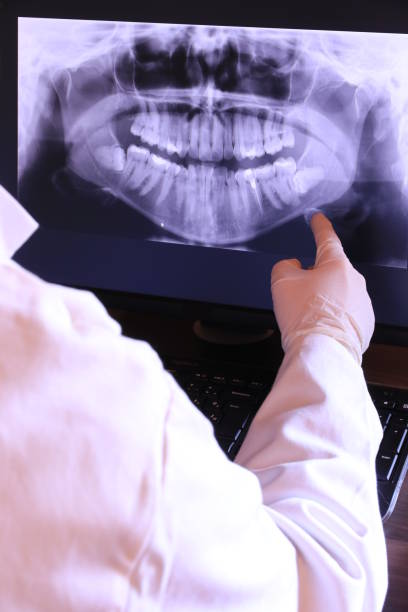 Best Emergency Root Canal Treatment in Gibson, AR