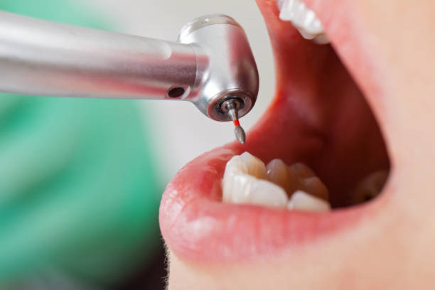 Best Pediatric Emergency Dentist in Gibson, AR